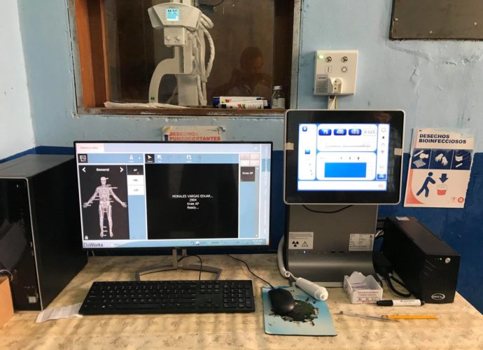 Zacapa: Hospital fortalece sus servicios con rayos X digital