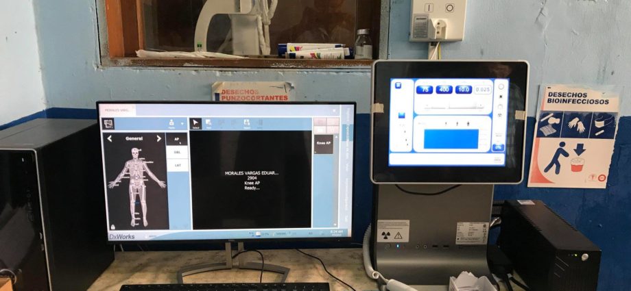 Zacapa: Hospital fortalece sus servicios con rayos X digital