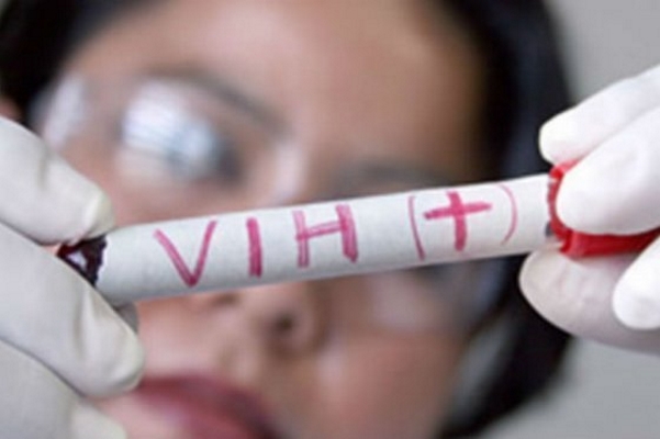 Lanzan estrategia de Inicio Rápido para atender a personas con VIH