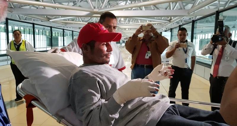 Paciente retorna de México recuperado de quemaduras provocadas por el volcán de Fuego