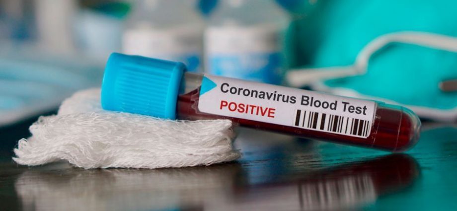 Coronavirus: Guatemala supera los 49 mil recuperados