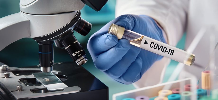 Coronavirus: Se reportan 711 nuevos casos
