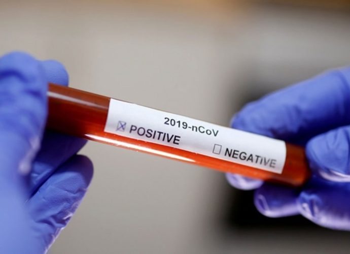Coronavirus: Se confirman 3 nuevos casos, uno de ellos en estado delicado