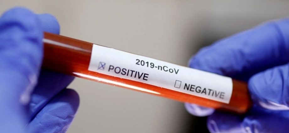 Coronavirus: Se confirman 3 nuevos casos, uno de ellos en estado delicado