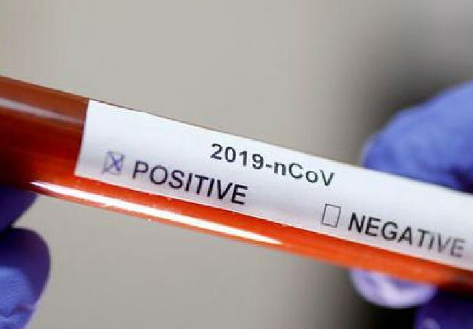 En los próximos días 8 laboratorios realizarán de forma gratuita las pruebas de Coronavirus