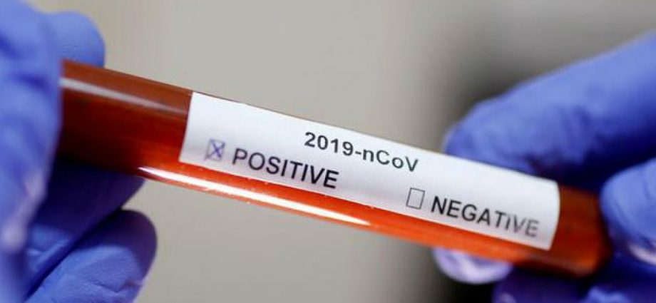 En los próximos días 8 laboratorios realizarán de forma gratuita las pruebas de Coronavirus
