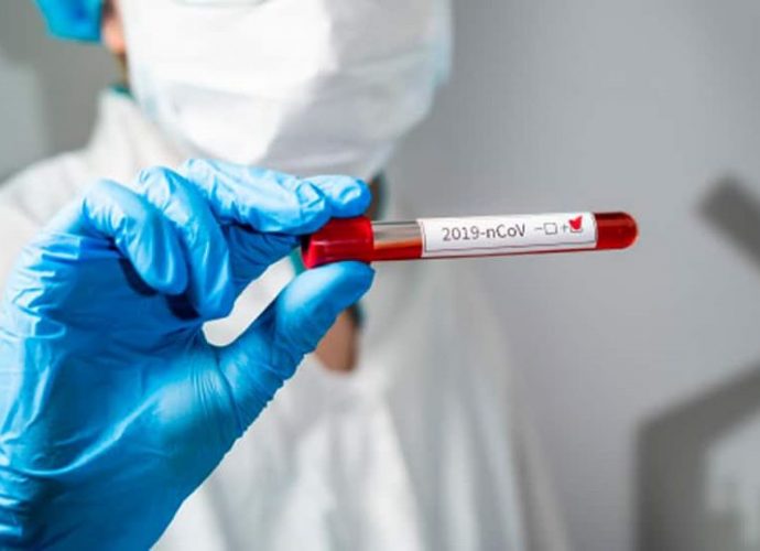 Unión Europea dona 70 mil pruebas para detectar COVID-19 Unión Europea dona 70 mil pruebas para detectar COVID-19