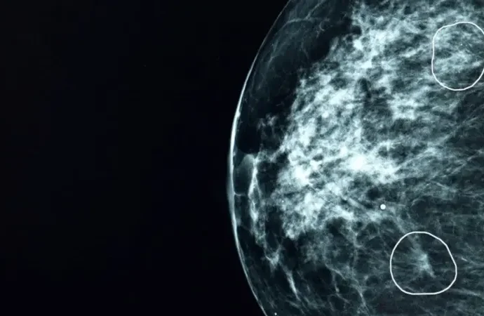 Revolución en el Diagnóstico: IA Británica Detecta Tumores de Cáncer Indetectables para el Ojo Humano